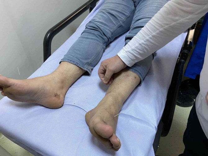 Uzmanlardan "Hacamat" Uyarısı: “Yanlış Uygulamalar Ömür Boyu Geçmeyen Ağrılar Oluşturuyor”