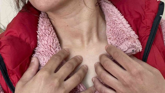 Eski Sevgili Hem Kadını Hem Çocuğunu Darp Edip Yaraladı