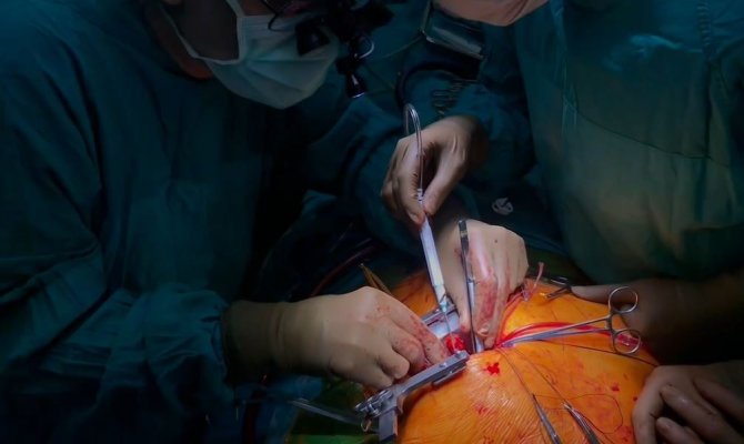 Bu Yöntem Bir Hastayı Daha Sağlığına Kavuşturdu