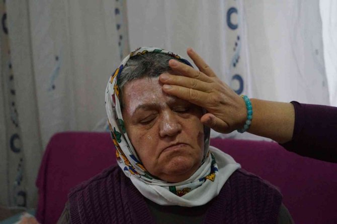 Yangında Annesini Kaybetti, Canını Zor Kurtardı