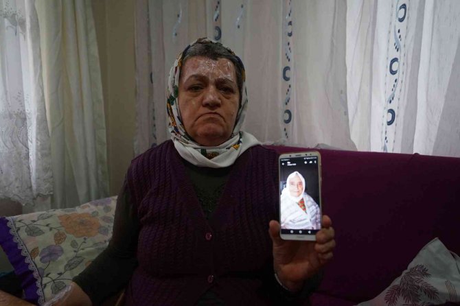 Yangında Annesini Kaybetti, Canını Zor Kurtardı