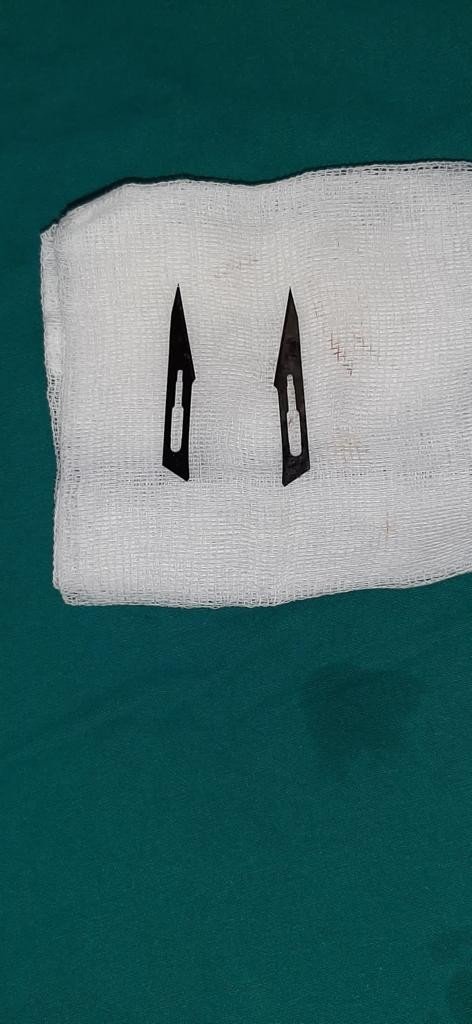 Karın Ağrısı Şikayetiyle Gitti, 2 Tane Neşter Yuttuğunu Öğrendi