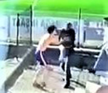 Amigonun Attığı Yumrukla Burnu Kırılan Futbolcu Ameliyat Oldu