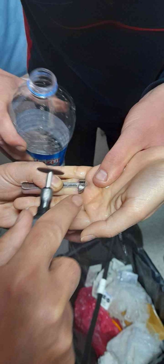 Parmağa Sıkışan Yüzüğü İtfaiye Ekipleri Çıkardı