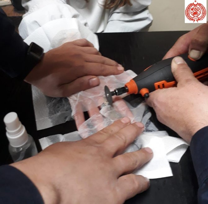 Parmağına Sıkışan Yüzüğü İtfaiye Çıkardı.