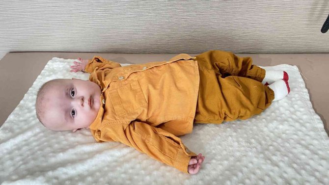 200 Binde Bir Görülen Hastalıkla Doğan Bebek Annesinin Karaciğeri İle Hayata Tutundu