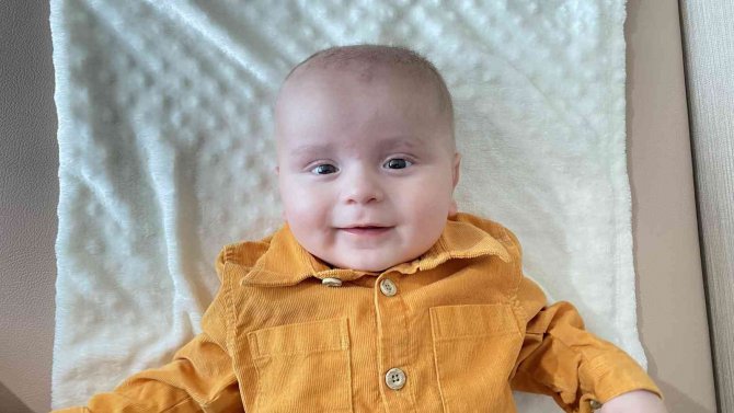 200 Binde Bir Görülen Hastalıkla Doğan Bebek Annesinin Karaciğeri İle Hayata Tutundu