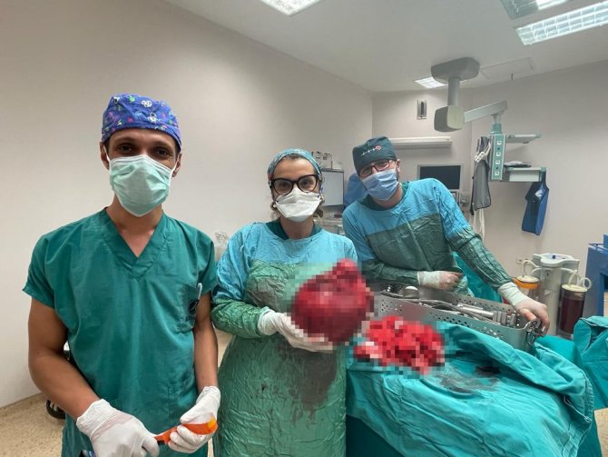 Kars’ta 65 Yaşındaki Kadından 6 Kilo Kitle Çıkarıldı