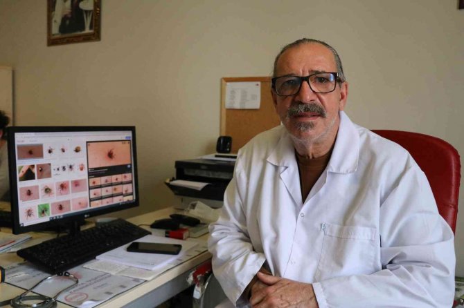 Yaz Aylarının Korkulu Rüyası Kene Tutulmalarına Karşı Önemli Uyarı