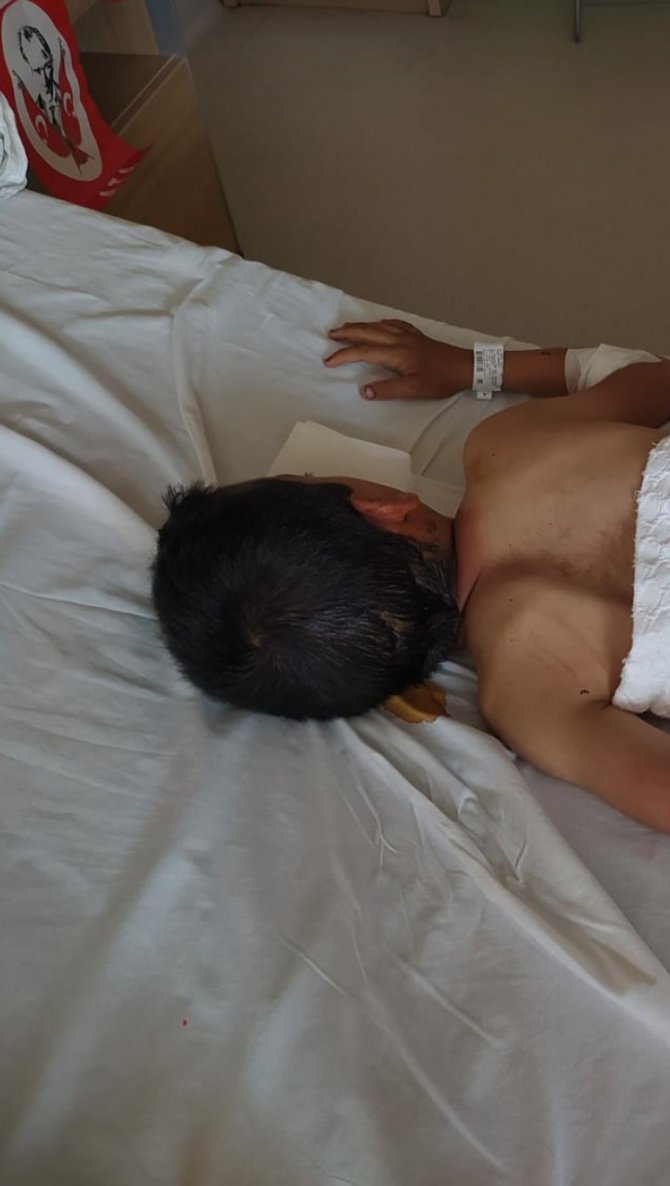 Ankara’da 8 Yaşındaki Çocuğa Köpek Saldırdı