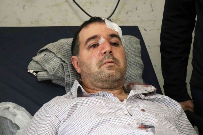 ‘Beni Taciz, Rahatsız Ediyorsun’ Diyerek Saldırdığı Aile Hekiminin Burnunu Kırdı