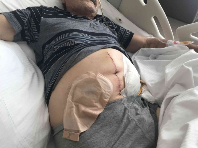 Pide Almak İçin Girdiği Kuyrukta 68 Yaşındaki Kıbrıs Gazisini Acımadan Dövdüler