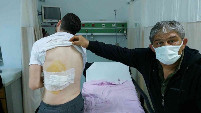 Ankara’dan Bayram İçin Geldiği Samsun’da Sokak Köpeğinin Saldırısına Uğradı