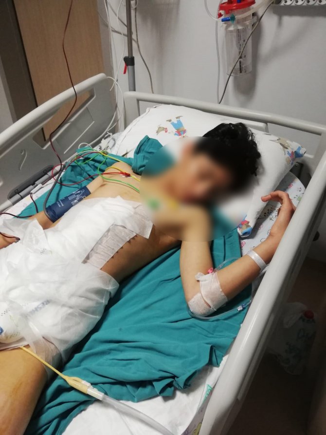 Köpeklerden Kaçarken Düşen Çocuk Ağır Yaralandı