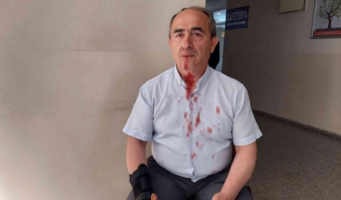 Davada Ortalık Karıştı, Kavgayı Ayırmaya Çalışan Avukat Da Darp Edildi