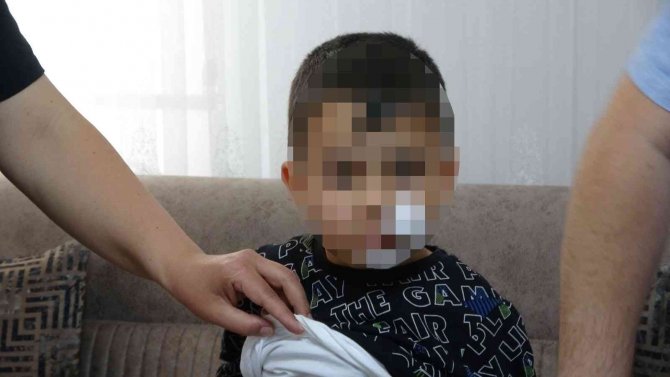 Anaokulu Öğrencisi Dehşeti Yaşadı