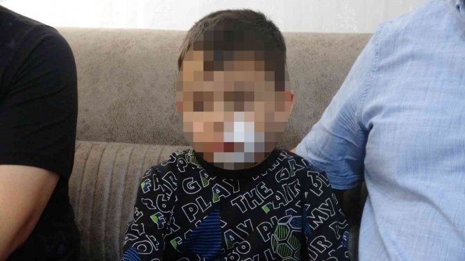 Anaokulu Öğrencisi Dehşeti Yaşadı