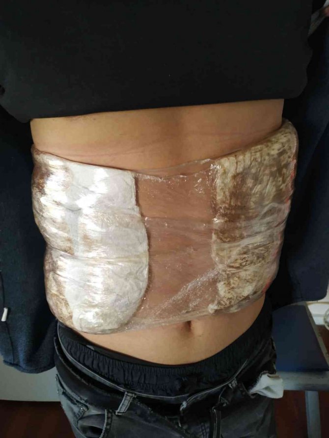 Vücuduna Sardığı 940 Gram Esrarla Otobüste Yakalandı