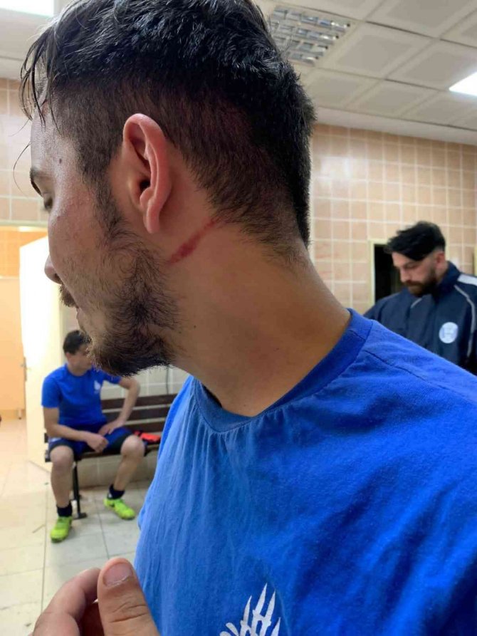 Pendik’te Amatör Maçta Saha Boks Ringine Döndü 4 Futbolcu Yaralandı