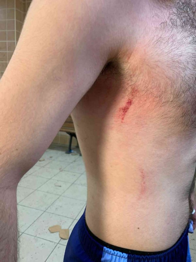 Pendik’te Amatör Maçta Saha Boks Ringine Döndü 4 Futbolcu Yaralandı