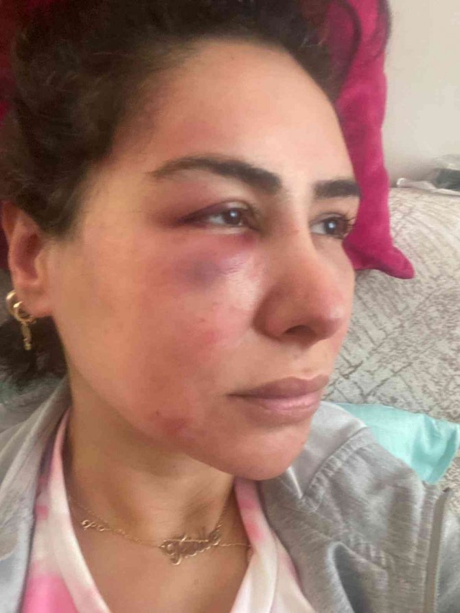 Genç Kadına Dehşet Yaşatan Zanlı Tutuklandı