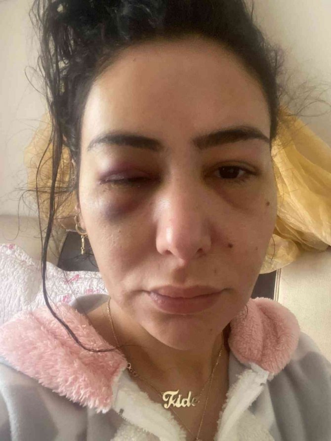 Genç Kadına Dehşet Yaşatan Zanlı Tutuklandı