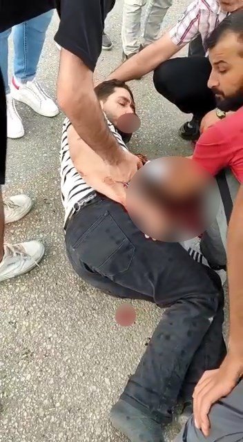 Bursa’da Otomobile Çarpan Motosiklet Sürücüsü Kanlar İçerisinde Kaldı