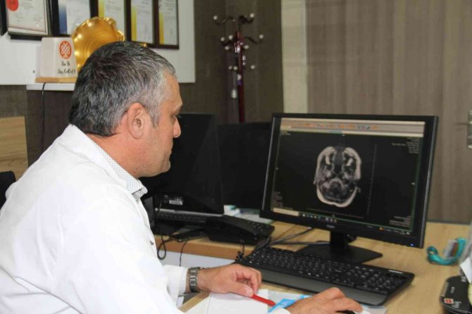 Uzm Dr. Kapan: "Ms Hastalığı Erkeklere Oranla Kadınlarda 2 Kat Daha Fazla Görülür"