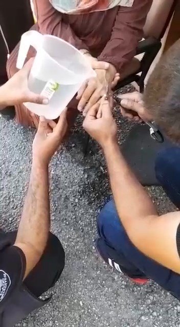 Elazığ’da Parmağa Sıkışan Yüzüğü İtfaiye Ekipleri Çıkardı