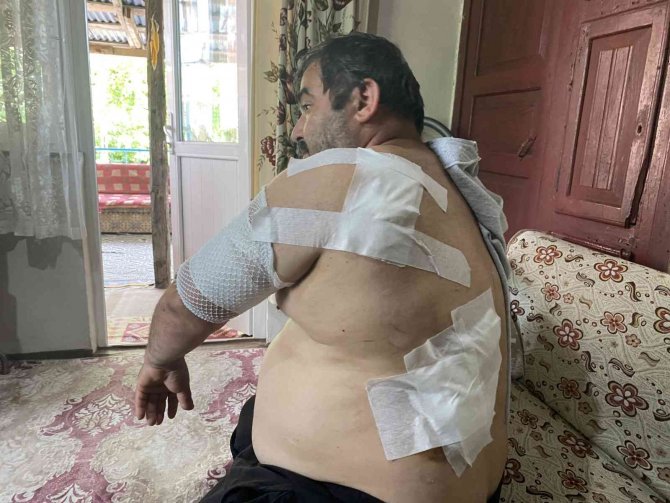 Ayı Saldırısına Uğrayan Vatandaş: “Beni Öldü Zannetti”