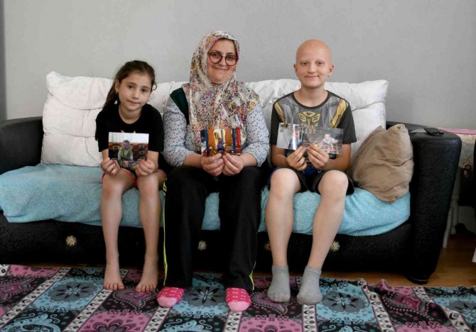 11 Yıl Önce Berbere Gitti Bir Daha Saçları Çıkmadı