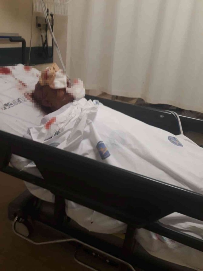 Beslediği Komşusunun Köpeğinin Saldırısına Uğradı