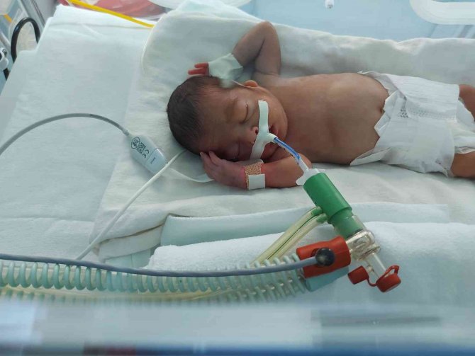 810 Gram Doğan ’Cesur’ Bebek