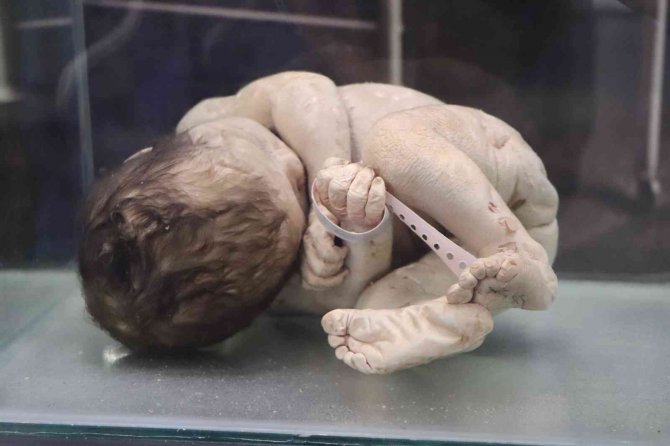 Asırlık Cerrahi Aletler Bu Müzede