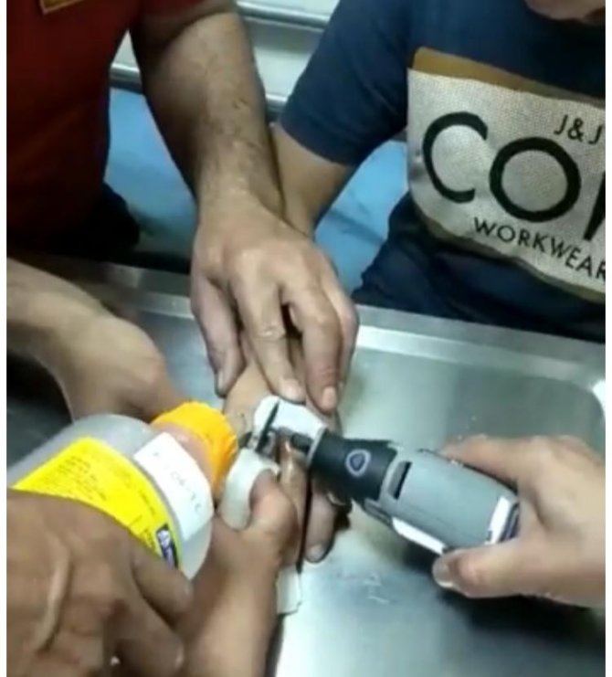 Çocuğun Parmağına Sıkışan Metal Somunu İtfaiye Çıkarttı