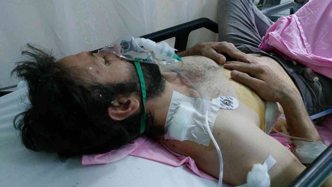 İ̇nşaat Ustasının Omzuna İsabet Eden Yorgun Mermi Ağır Yaraladı