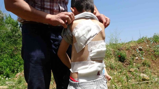 Bingöl’de 6 Yaşındaki Çocuk Köpeklerin Saldırısına Uğradı