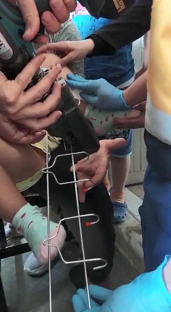 Oyun Oynarken Bacağına Demir Askılığın Kancası Saplandı