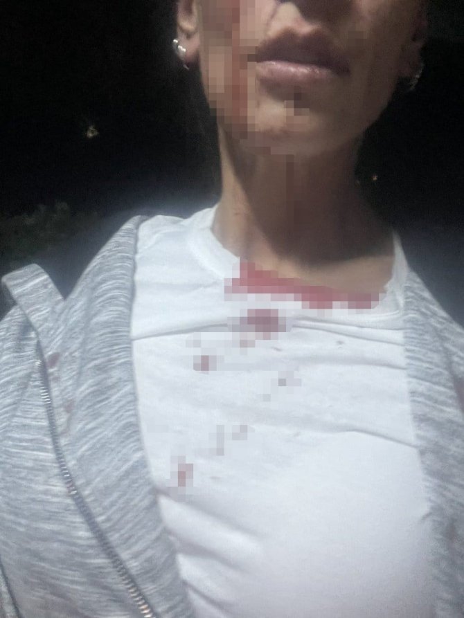 Esenyurt’ta Site İçerisinde Alkol Aldığı İddia Edilen Kadınları Tekme Tokat Dövdüler