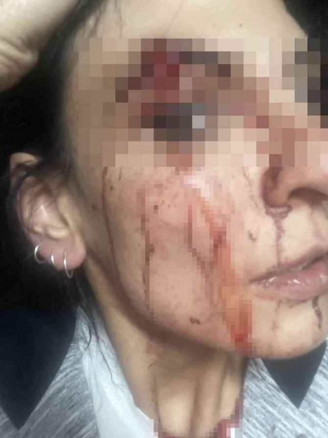 Esenyurt’ta Site İçerisinde Alkol Aldığı İddia Edilen Kadınları Tekme Tokat Dövdüler