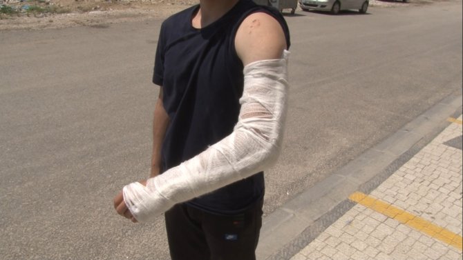 Bisikletiyle Üniversiteye Giden Öğrenci Sokak Köpeklerinin Saldırısına Uğradı