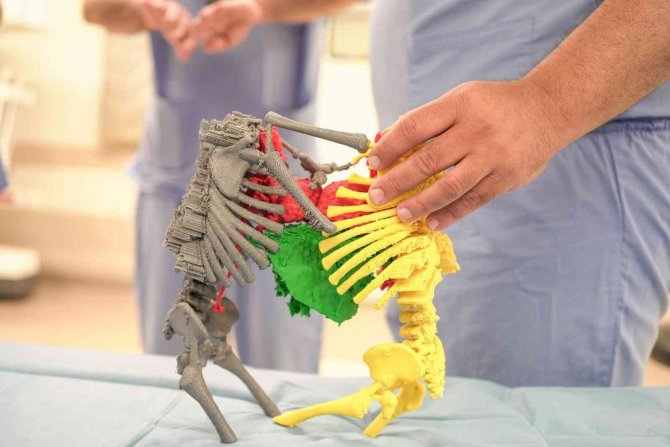 Cezayirli Yapışık İkizler Türkiye’de 9 Saat Süren Operasyonla Ayrıldılar