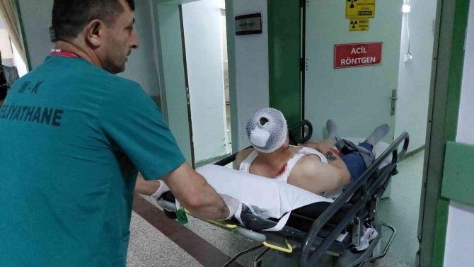 Samsun’da Silahlı Saldırıya Uğrayan Kardeşler Yaralandı