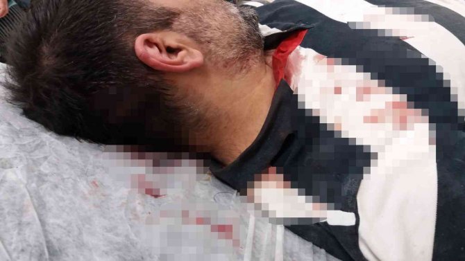 Büyükada’da Kaçak İnşaatı Görüntülemek İsteyen Gazeteciye Kazma Kürek İle Saldırdılar
