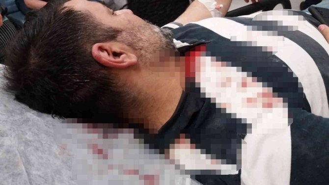 Büyükada’da Kaçak İnşaatı Görüntülemek İsteyen Gazeteciye Kazma Kürek İle Saldırdılar