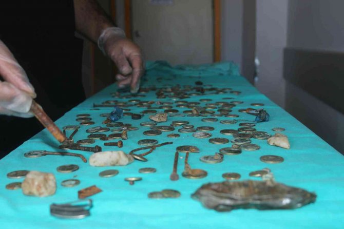 Van’da Akıl Almaz Olay: Midesinden 83 Tl Madeni Para Çıktı