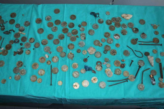 Van’da Akıl Almaz Olay: Midesinden 83 Tl Madeni Para Çıktı