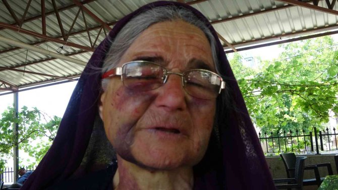 Kuzusunu Sürüden Almak İsterken Dayak Yedi, Yüzü Tanınmaz Hale Geldi