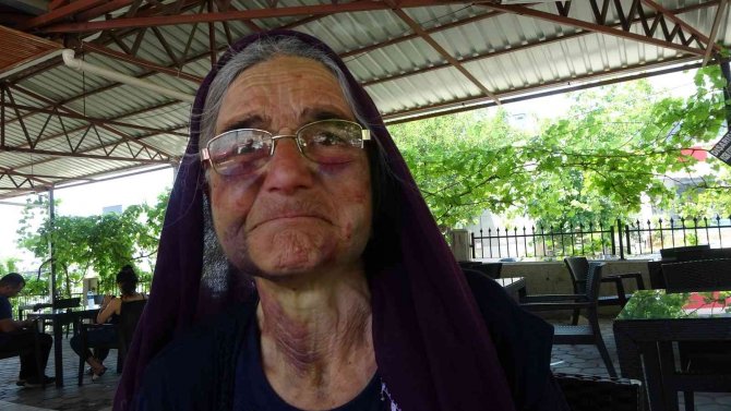 Kuzusunu Sürüden Almak İsterken Dayak Yedi, Yüzü Tanınmaz Hale Geldi