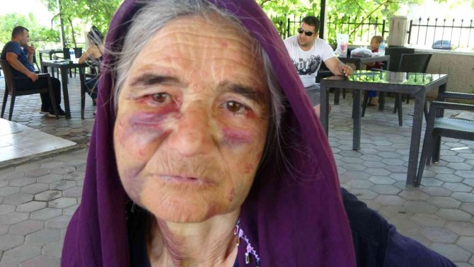 Kuzusunu Sürüden Almak İsterken Dayak Yedi, Yüzü Tanınmaz Hale Geldi